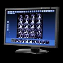 Global Medical Display Market